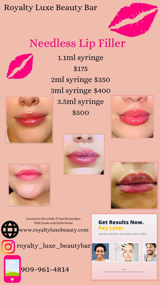 Juicy Lips - Lip Filler (Lip Enhancement)